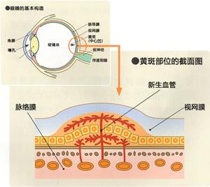 关于老年性黄斑变性｜眼科疾病和症状｜真生会富山医院眼科中心