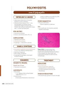 Polymyositis: Video, Causes, & Meaning | Osmosis