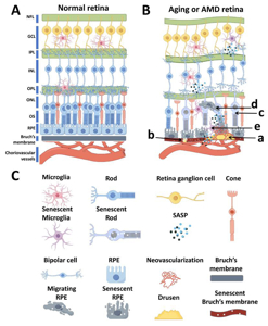 细胞衰老与年龄相关性黄斑变性