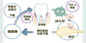 糖友牙痛无小事，控制血糖是关键- 医学科普- 信息公开- 郑州大学 ...