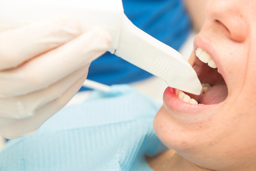 Intraoral digital scanner used on teeth in an Indian clinic